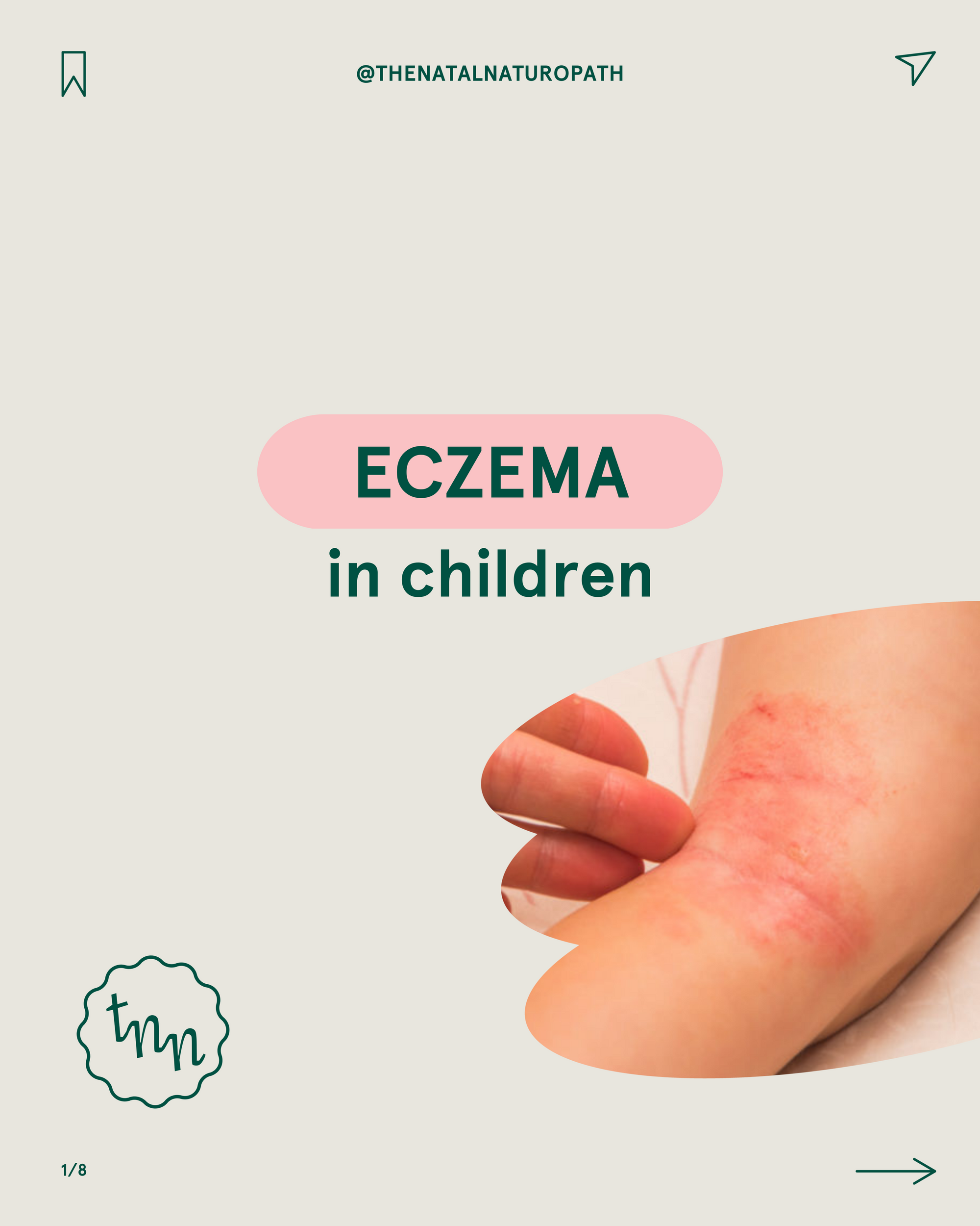 The root causes and natural treatments of eczema in children